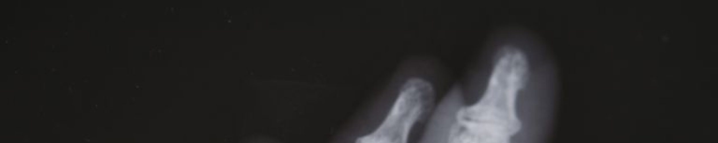 大阪で実現するインビザライン、あなたの美しい笑顔を作る秘訣とは？